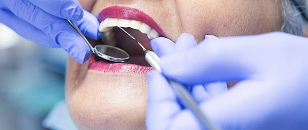 Best Emergency Treatment for Dental Infections or Abscesses in Taos, MO